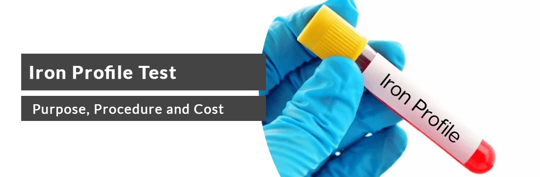 Iron Profile Test: Cost, Preparation and Procedure